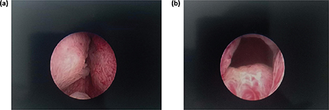 Fig 6
