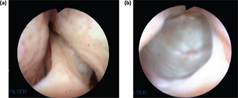 Fig 8