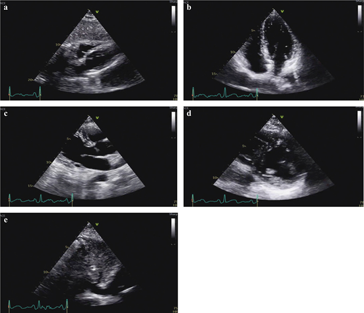 Fig 1